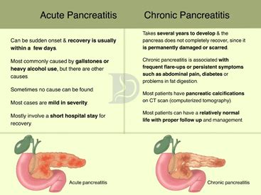 Pancreatic Diseases Digestive And Liver Health Specialists