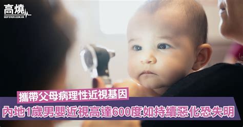 【兒童近視】內地1歲男嬰雙眼近視高達600度！醫生判斷嬰兒攜帶父母病理性近視基因如持續惡化恐致失明