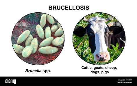 Brucellosis Illustration Illustration Of Bacteria Brucella And Photo