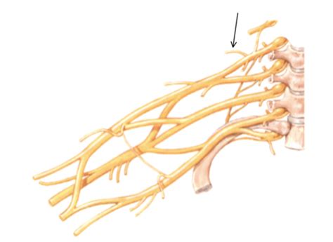 Brachial Plexus Flashcards Quizlet