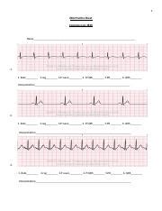 EKG Practice Strips with answers.docx - 1 EKG Practice Sheet Complex ...