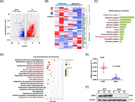 Gene Expression Profiling Identifies Nsd2 As Marker Of Senescent Bone