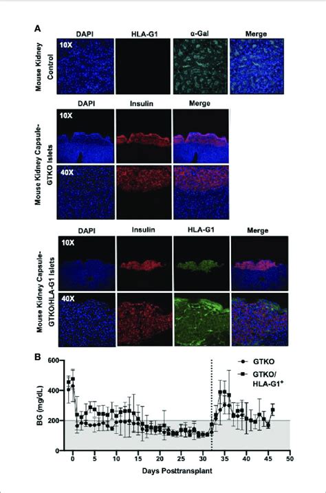 Kidney Capsule Islet Transplantation Characterization A Mouse