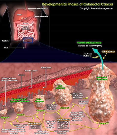 Colorectal Cancer Pathways