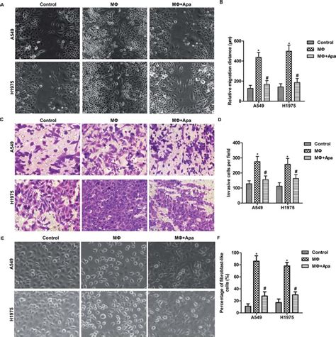 Apatinib Inhibits Polarized Macrophage Induced Migration And Invasion