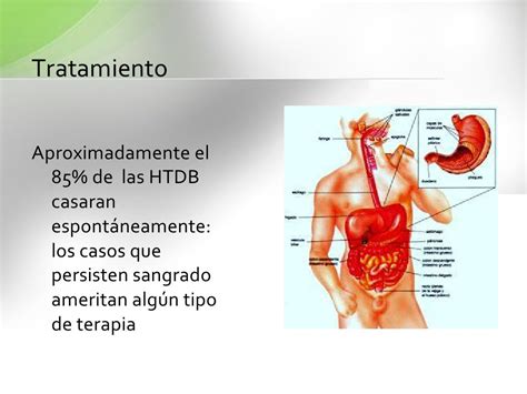 Sangrado Tubo Digestivo Alto Y Bajo Stda