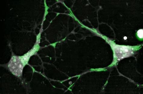 Mitochondrial Trafficking In Neurons Nanolive A Complete Solution