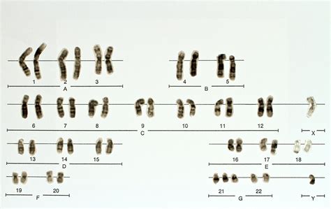 Stop Codon The Definitive Guide Biology Dictionary