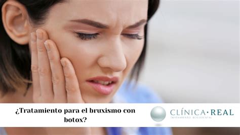 Tratamiento Para El Bruxismo Con Botox Todo Lo Que Necesitas Saber