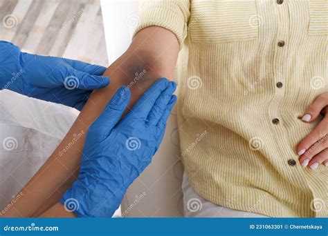 Doctor Checking Woman`s Elbow With Bruise At Hospital Closeup Stock