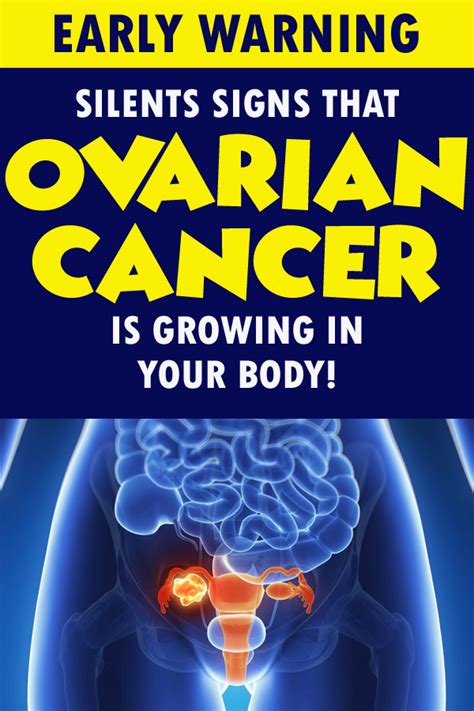 7 Signs Of Ovarian Cancer You Might Be Ignoring