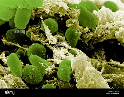 Bacteria yersinia pestis hi-res stock photography and images - Alamy