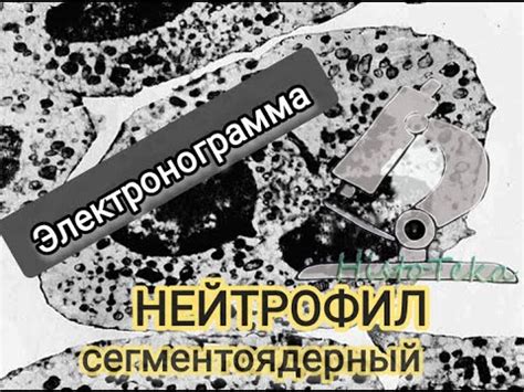 НЕЙТРОФИЛ (электронограмма) - YouTube