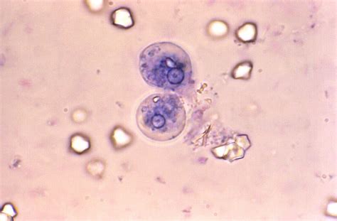 Entamoeba Moshkovskii Trophozoites Acheter Une Photo 13504385 Science Photo Library