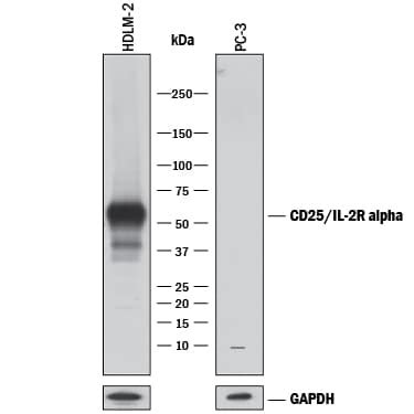 Human Cd Il R Alpha Antibody Af Na By R D Systems Part Of Bio