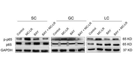 Bay 11 7082 Bay 11 7821 Iκbα Nf κb Inhibitor Medchemexpress