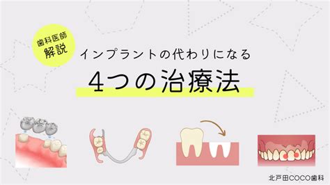 インプラントに代わる治療はある？4つの選択肢を専門医が徹底解説 戸田市のインプラント治療｜北戸田coco歯科