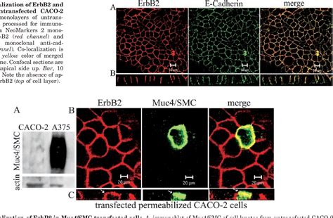 Figure 1 From Muc4 Sialomucin Complex The Intramembrane ErbB2 Ligand