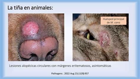 Dermatofitosis Tiñas Ppt