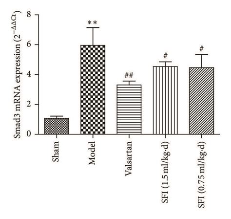 Sfi Regulates Expression Of Tgf β1 Smad2 Smad3 And Smad7 Mrna In Rat