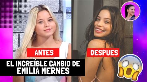 El Increible Cambio De Emilia Mernes Te Mostramos El Antes Y