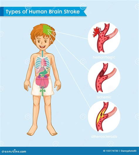 Ejemplo Médico Científico Del Concepto Del Movimiento Del Cerebro Ilustración Del Vector