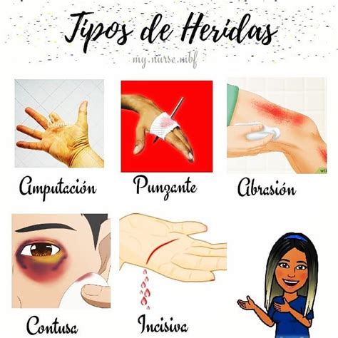 Estudiantes De Enfermeria On Instagram Heridas Las Heridas Son