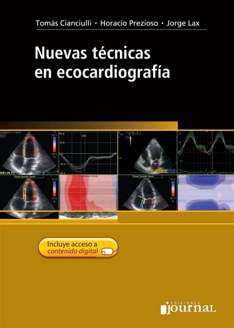 Nuevas Tecnicas En Ecocardiografia Ebook En Laleo