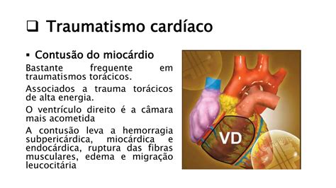 Traumatismo Toracico Finalpptx