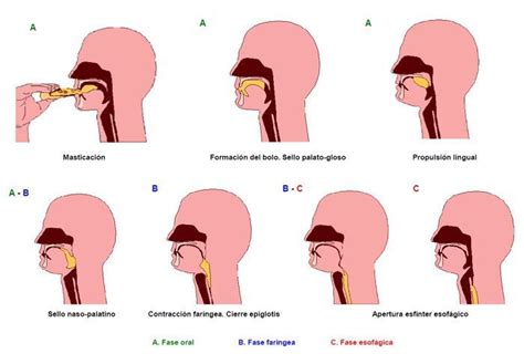 Todo Sobre La Disfagia Causas Y Lo Que Debes Hacer Si Detectas Que Padeces De Disfagia Por El