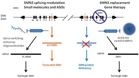 Spinal Muscular Atrophy Diagram