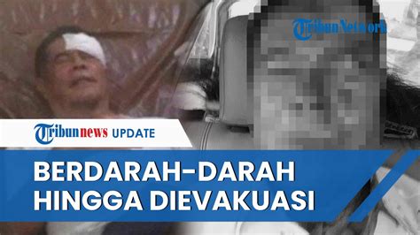 Kondisi PJ Gubernur Papua Berdarah Darah Saat Ricuh Iringi Jasad Lukas