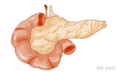 “癌中之王”胰腺癌的早期症状有哪些？ 知乎