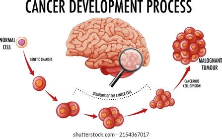 Diagram Showing Cancer Development Process Illustration Stock Vector