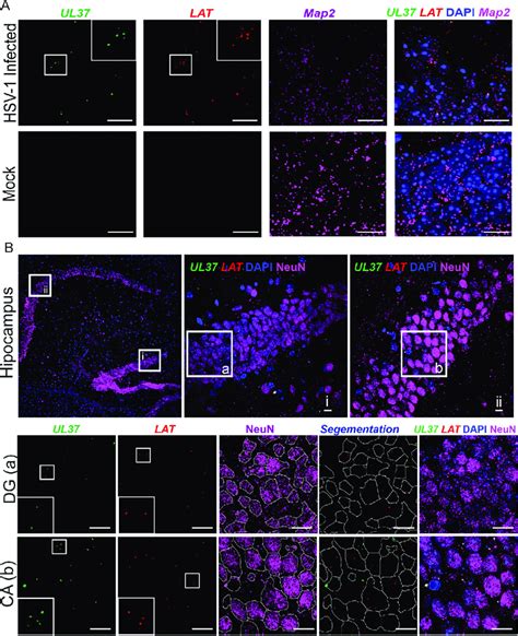 Rnascope Multiplex Fluorescent Assay To Detect Hsv Mrna In Labeled