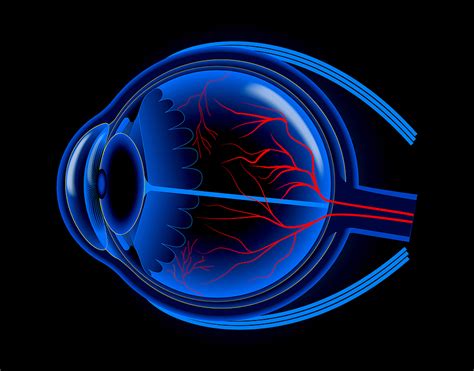 Corneal Cross Linking New Jersey Whippany Nj Laser Vision