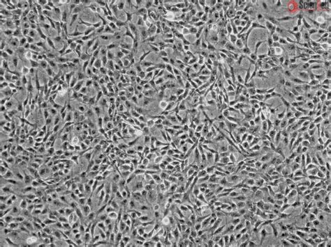 Human Retinal Pigment Epithelial Cells (HRPEpiC)
