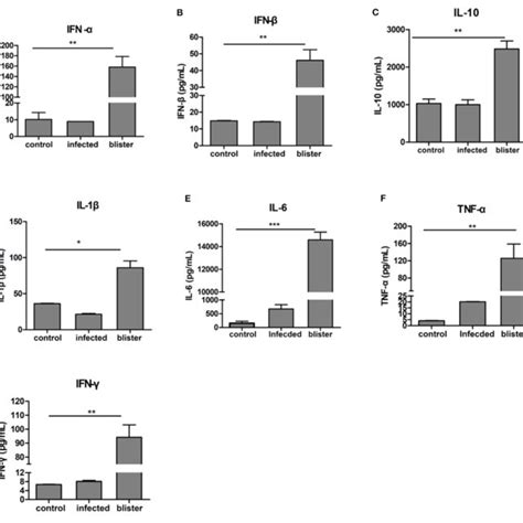 Differential Expression Of Cytokines In The Vesicular Fluid After