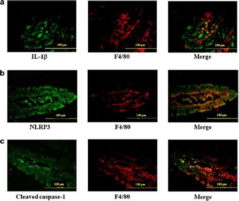 Localization Of Interleukin 1β Il 1β Nlrp3 And Cleaved Caspase 1 In