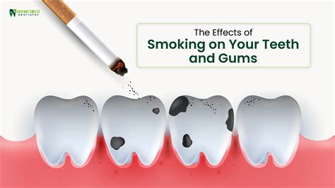 Smoking's Impact on Teeth and Gums: Risks and Solutions