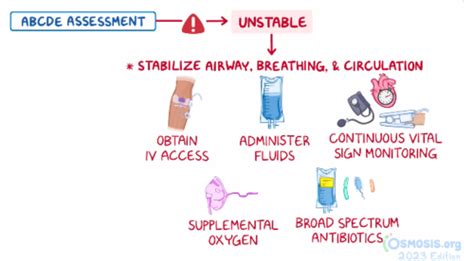 28 Diagnosis Differential Diagnosis Treatment Of Acute