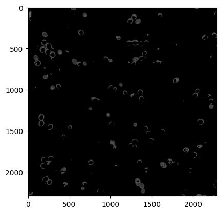 Python Counting Yeast Cells From A Hemocytometer Image Using OpenCV