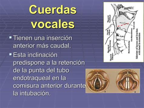 La Respiracion Y Termorregulacion En El Recien Nacido Ppt