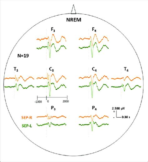 Average N 19 Brain Responses To Nonpainful Tactile Stimulations In