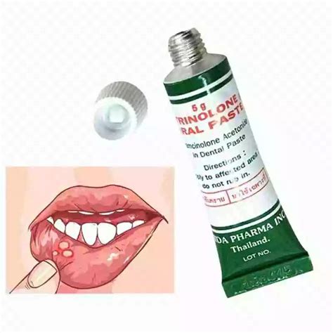 Jual Nida Trinolone Oral Paste Obat Sariawan Grm Original Thailand