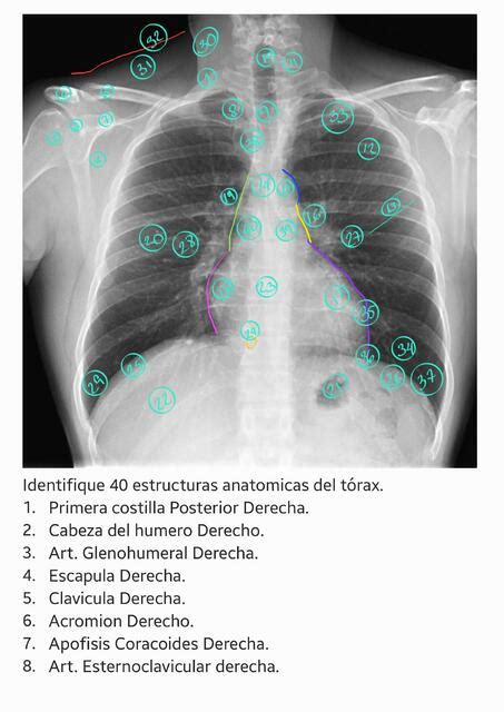 Partes En Un Rx De T Rax Ismarah Mileynn Udocz