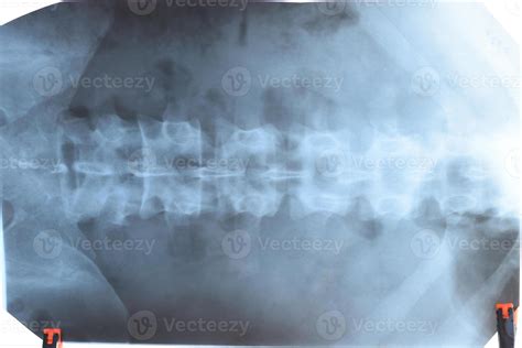 X ray of the lumbar spine, spine on x-ray 38459059 Stock Photo at Vecteezy