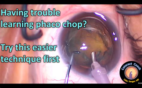 Trouble Learning Phaco Chop Try This First Cataract Coach™