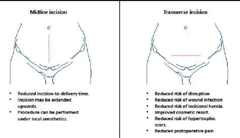 Cesarean Section Technique With Diagram