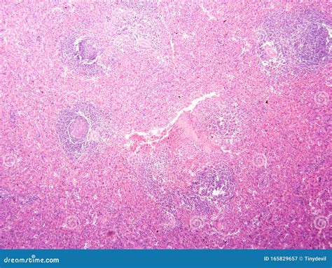 Histology Of Human Pancreas Tissue Stock Image Image Of Squamous